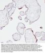 Anti-Angiostatin K1-3/PLG Antibody PicobandÂ®