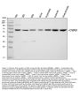 Anti-Cystathionine beta-synthase CBS Antibody Picoband®