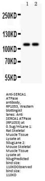 Anti-SERCA1 ATPase/ATP2A1 Antibody Picoband®