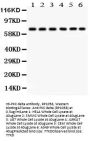Anti-PKC delta/PRKCD Antibody Picoband®