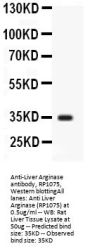 Anti-liver Arginase/ARG1 Antibody Picoband®