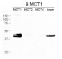Anti MCT1 pAb