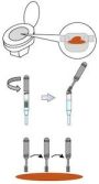 Feces sampling kit for gut microbiota analysis with preservative solution (brush type / feces sampling sheet)