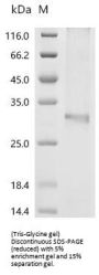 Recombinant Mouse Cholesterol 25-hydroxylase(Ch25h)