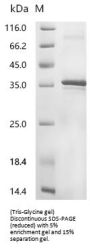 Recombinant Human 2-acylglycerol O-acyltransferase 2(MOGAT2)