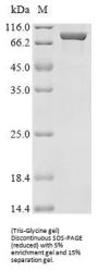 Recombinant Mouse Sarcosine dehydrogenase, mitochondrial(Sardh) ,partial