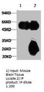 TUBA1A Monoclonal Antibody