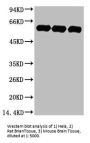 TUBA1A Monoclonal Antibody