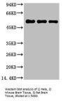 TUBB1 Monoclonal Antibody