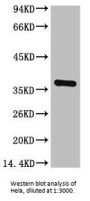 GAPDH Monoclonal Antibody