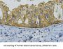 ERBB2 Monoclonal Antibody
