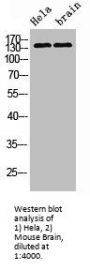 ERBB2 Monoclonal Antibody