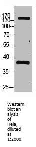 PTPRC Monoclonal Antibody