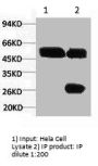 KRT7 Monoclonal Antibody