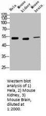 KRT7 Monoclonal Antibody