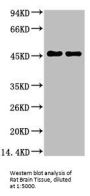 GFAP Monoclonal Antibody