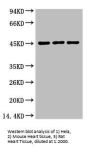 AQP4 Monoclonal Antibody