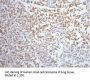 ENO2 Monoclonal Antibody
