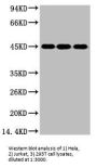 ENO2 Monoclonal Antibody