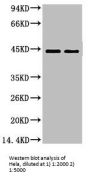 CASP9 Monoclonal Antibody