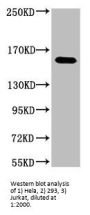 ERBB2 Monoclonal Antibody