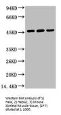 KRT18 Monoclonal Antibody