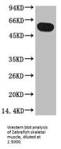 TUBB1 Monoclonal Antibody