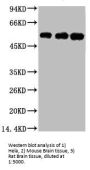 TUBB3 Monoclonal Antibody