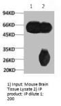 TUBB3 Monoclonal Antibody