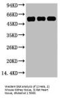 TUBB3 Monoclonal Antibody