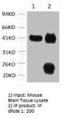 ACTA1 Monoclonal Antibody