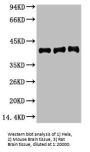 ACTA1 Monoclonal Antibody