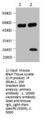 TUBB2A Monoclonal Antibody