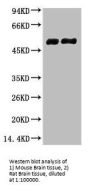 TUBB2A Monoclonal Antibody