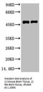 FN1 Monoclonal Antibody