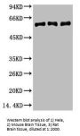 VIM Monoclonal Antibody