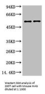 VIM Monoclonal Antibody