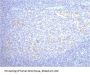 CD68 Monoclonal Antibody