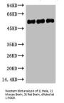 TUBB3 Monoclonal Antibody