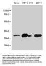 BCL2 Monoclonal Antibody