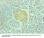 ENO2 Monoclonal Antibody