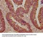 LGALS3 Monoclonal Antibody