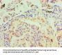 Mouse anti-human MSH6 monoclonal antibody