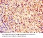 NES Monoclonal Antibody