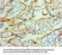 TGM2 Monoclonal Antibody