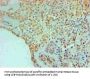 TGM2 Monoclonal Antibody