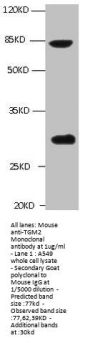 TGM2 Monoclonal Antibody