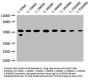 TUBB Monoclonal Antibody