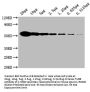 TUBB Monoclonal Antibody