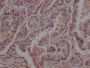 TUBB Monoclonal Antibody
